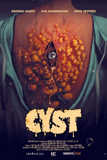 Cyst ( 2020 )
